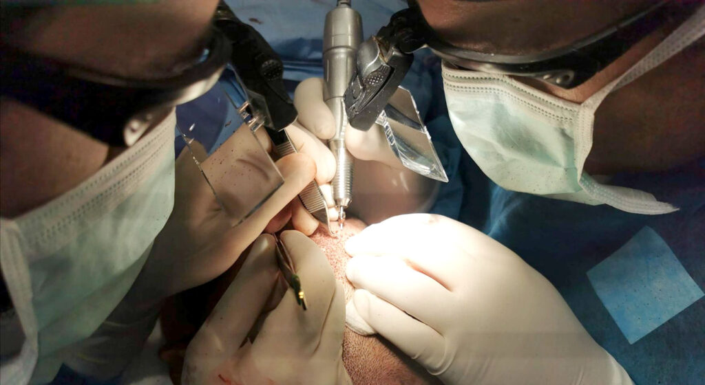 Dr. Henrique Machado durante procedimento de transplante capilar